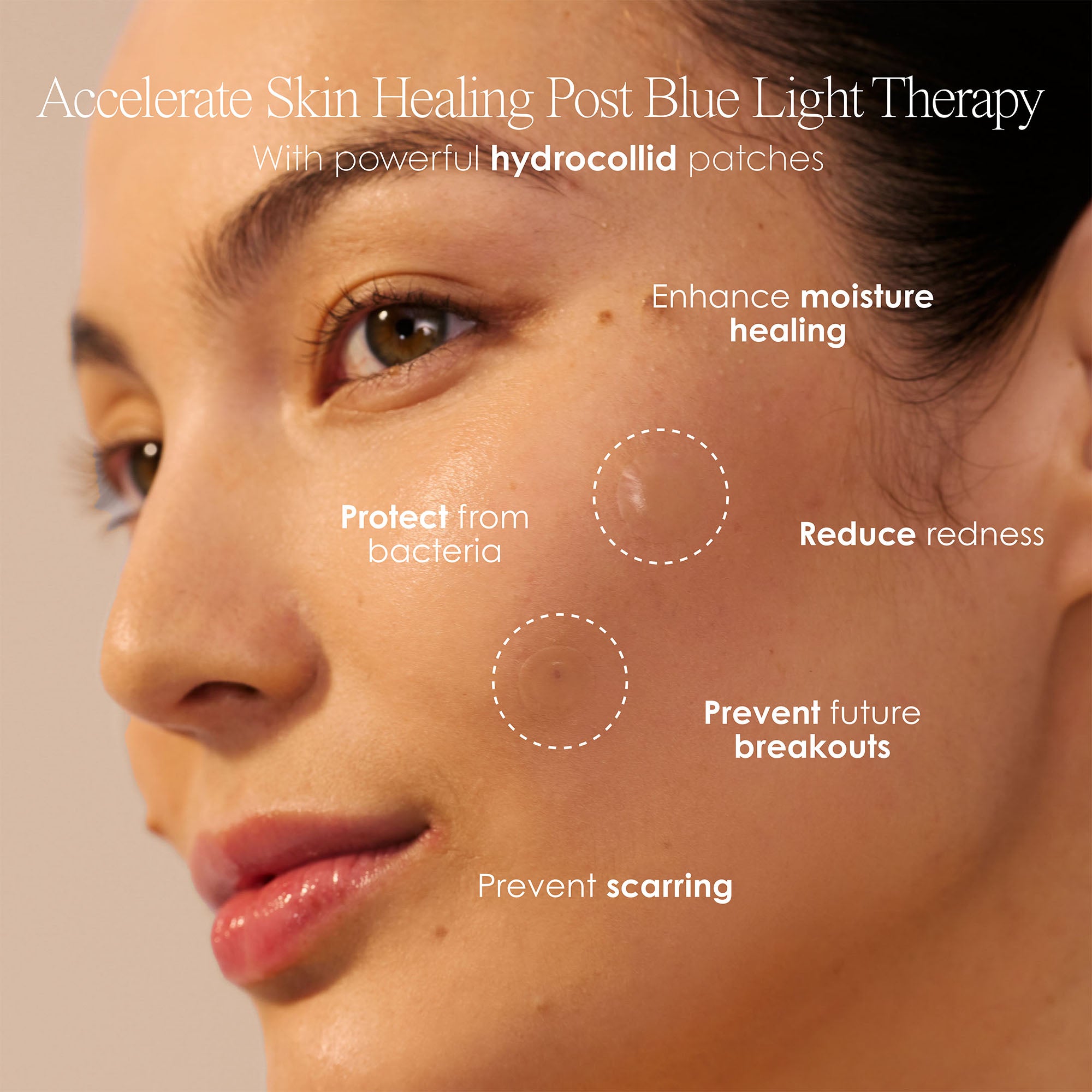 Clear + Glow Acne Patches (72 pcs) - Project E Beauty